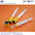 Vakuum-Blutentnahmeröhrchen Sst Tube (ENK-CXG-021)